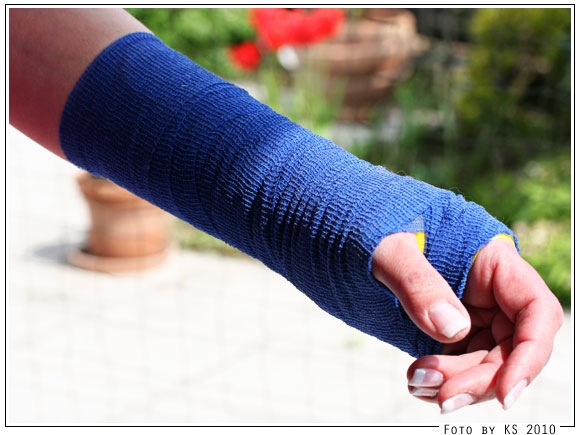 blauer_arm.jpg